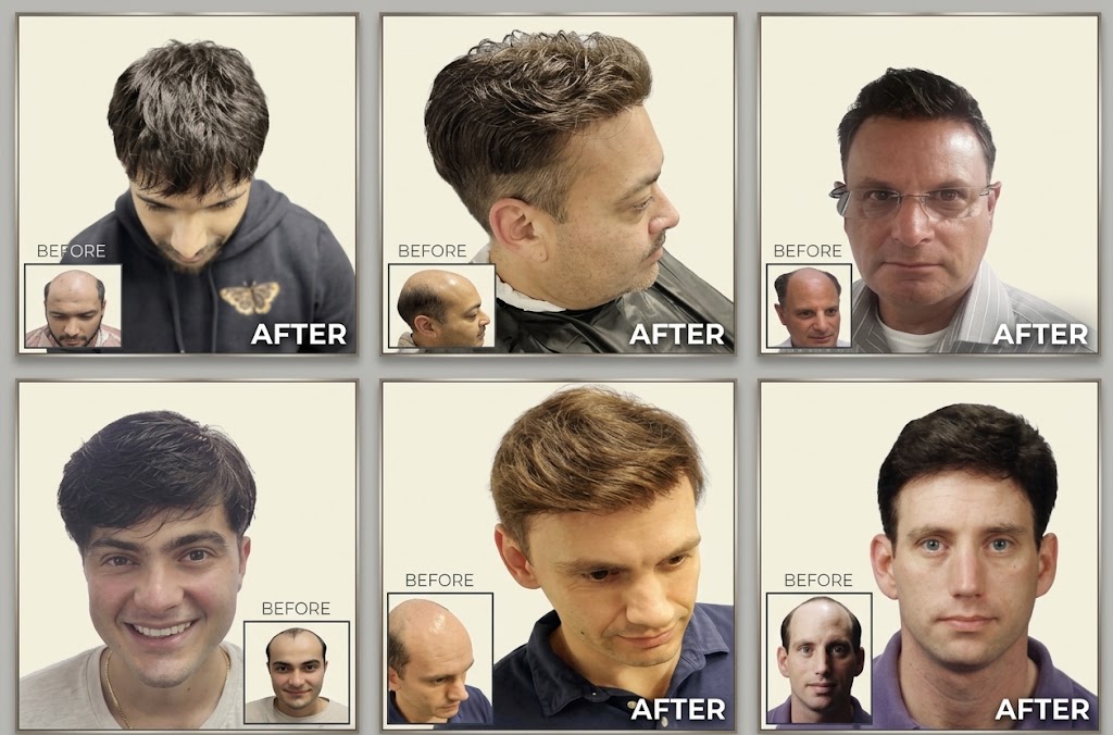 new befor and after edited